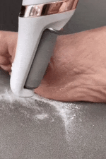 Electric foot callus remover