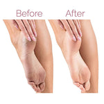 Electric foot callus remover